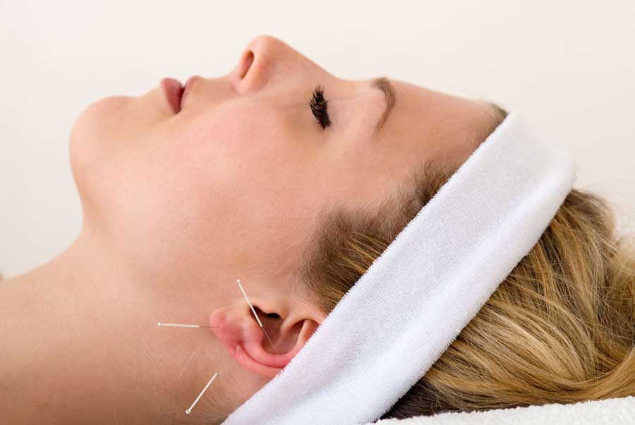 AURICULOTHERAPY