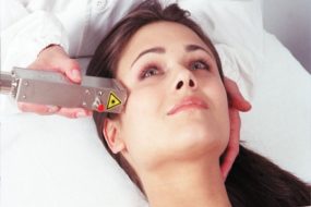 VITALASE